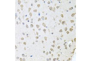 Immunohistochemistry (IHC) image for anti-threonyl-tRNA Synthetase (TARS) (AA 1-230) antibody (ABIN6148858)