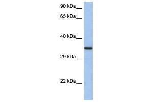 HORMAD2 antibody used at 1 ug/ml to detect target protein. (HORMAD2 Antikörper  (N-Term))