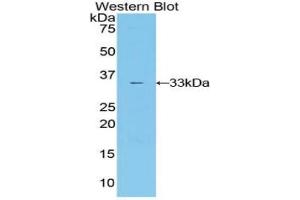 Western blot analysis of the recombinant protein. (IL20RA Antikörper  (AA 268-538))