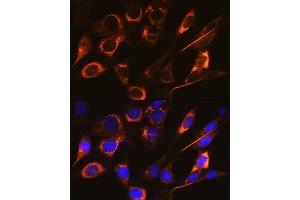 Immunofluorescence analysis of NIH-3T3 cells using SFRP4 Rabbit mAb (ABIN7270180) at dilution of 1:100 (40x lens). (SFRP4 Antikörper)
