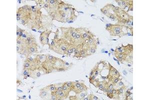 Immunohistochemistry of paraffin-embedded Human stomach using FGF13 Polyclonal Antibody at dilution of 1:100 (40x lens). (FGF13 Antikörper)