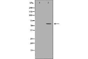 Western blot analysis of A549 whole cell lysates, using GGT1 Antibody. (GGT1 Antikörper  (N-Term))