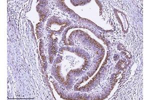 IHC analysis of ALDH3A1 using anti-ALDH3A1 antibody (ABIN7602181). (ALDH3A1 Antikörper  (AA 62-101))