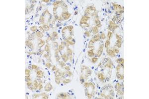 Immunohistochemistry of paraffin-embedded human stomach using MIP antibody (ABIN5971491) at dilution of 1/100 (40x lens). (MIP Antikörper)