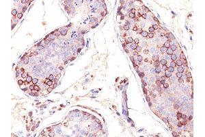 Formalin-fixed, paraffin-embedded human Testis stained with MAGE-1 Monoclonal Antibody (SPM282). (MAGEA1 Antikörper)