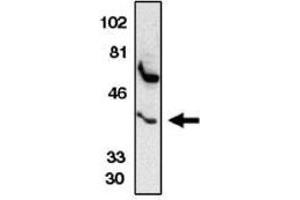 Image no. 1 for anti-Chemokine (C-C Motif) Receptor 5 (CCR5) (AA 6-20) antibody (ABIN265000)