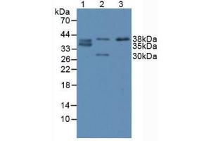 Western blot analysis of (1) Human SW480 Cells, (2) Porcine Large Intestine Tissue and (3) Porcine Small Intestine Tissue. (CDX2 Antikörper  (AA 1-313))