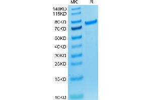 Biotinylated Cynomolgus PADI4 (Primary Amine Labeling) on Tris-Bis PAGE under reduced condition. (PAD4 Protein (AA 1-663) (His tag,Biotin))