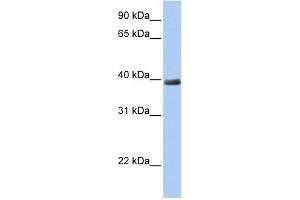 WB Suggested Anti-ZNF391 Antibody Titration:  0. (ZNF391 Antikörper  (N-Term))