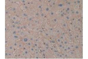 IHC-P analysis of Human Liver Tissue, with DAB staining. (ENPEP Antikörper  (AA 718-948))