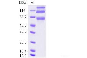 Western Blotting (WB) image for Coronavirus OC43 Spike Protein (HCoV-OC43 S) protein (His tag,ECD) (ABIN7198834) (hCoV-OC43 Spike Protein (His tag,ECD))