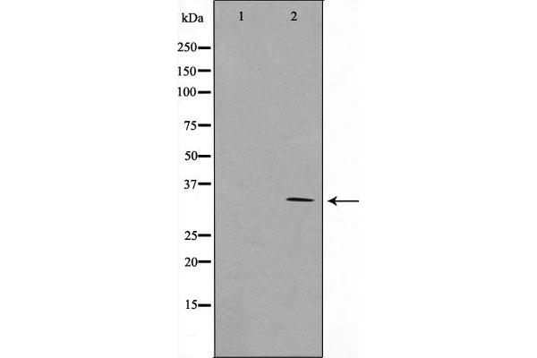 RNF144A Antikörper  (Internal Region)