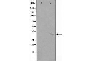Western blot analysis on COLO205 cell lysate using RNF144A Antibody，The lane on the left is treated with the antigen-specific peptide. (RNF144A Antikörper  (Internal Region))