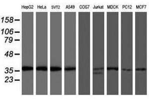 Image no. 1 for anti-O-Sialoglycoprotein Endopeptidase (OSGEP) (AA 1-335) antibody (ABIN1490751)