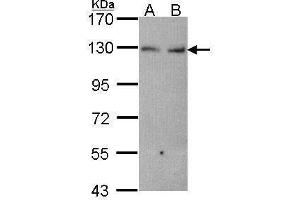 WB Image Sample (30 ug of whole cell lysate) A: Hela B: JurKat 7. (CDH6 Antikörper)