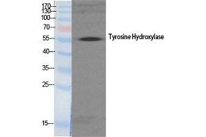 Western Blot (WB) analysis of specific cells using TH Polyclonal Antibody. (TH Antikörper  (Tyr161))