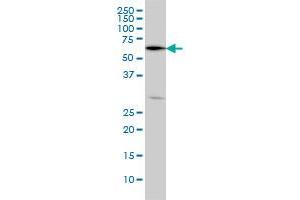 OXSR1 monoclonal antibody (M09), clone 5D5 Western Blot analysis of OXSR1 expression in HeLa . (OXSR1 Antikörper  (AA 351-450))