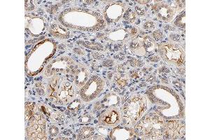 ABIN6266800 at 1/100 staining human kidney tissue sections by IHC-P. (MAP3K6 Antikörper  (C-Term))