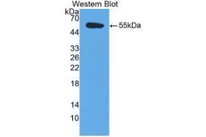 Western blot analysis of recombinant Human TFPI.