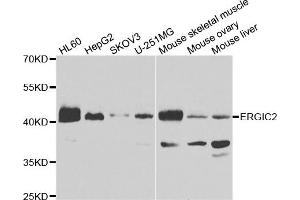 Western blot analysis of extracts of various cell lines, using ERGIC2 antibody. (ERGIC2 Antikörper)