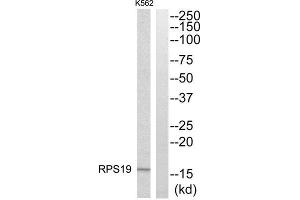 Western Blotting (WB) image for anti-Ribosomal Protein S19 (RPS19) (Internal Region) antibody (ABIN1850576) (RPS19 Antikörper  (Internal Region))