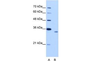 WB Suggested Anti-RBM4B Antibody Titration:  2. (RBM4B Antikörper  (C-Term))