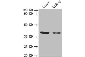 Western blot All lanes: FCGRT antibody at 5. (FcRn Antikörper  (AA 24-297))