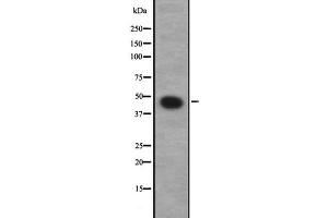 Western blot analysis of GNA12 expression in NT2D1 whole cell lysate,The lane on the left is treated with the antigen-specific peptide. (GNA12 Antikörper  (C-Term))
