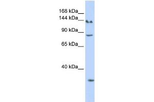 WB Suggested Anti-SIN3A Antibody Titration:  0. (SIN3A Antikörper  (N-Term))