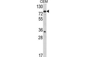 Western Blotting (WB) image for anti-Transglutaminase 4 (Prostate) (TGM4) antibody (ABIN5022825) (TGM4 Antikörper)