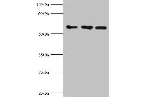 Western blot All lanes: ABCE1 antibody at 4 μg/mL Lane 1: 293T whole cell lysate Lane 2: Hela whole cell lysate Lane 3: k562 whole cell lysate Secondary Goat polyclonal to rabbit IgG at 1/10000 dilution Predicted band size: 67 kDa Observed band size: 67 kDa (ABCE1 Antikörper  (AA 320-599))
