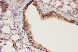 Anti-ALOX15 Picoband antibody,  IHC(P): Mouse Lung Tissue (ALOX15 Antikörper  (AA 2-337))