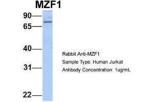 Host: Rabbit Target Name: MZF1 Sample Type: Jurkat Antibody Dilution: 1. (MZF1 Antikörper  (N-Term))