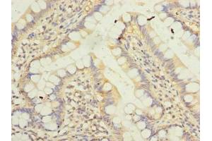 Immunohistochemistry of paraffin-embedded human small intestine tissue using ABIN7157240 at dilution of 1:100 (KLHDC8A Antikörper  (AA 1-350))