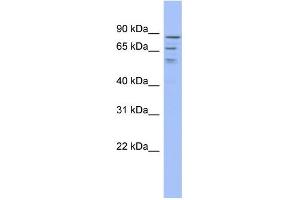 WB Suggested Anti-C1orf25 Antibody Titration:  0. (TRMT1L Antikörper  (Middle Region))