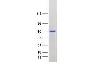 Coiled-Coil Domain Containing 51 (CCDC51) protein (Myc-DYKDDDDK Tag)