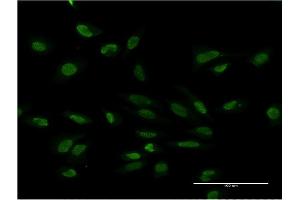 Immunofluorescence of monoclonal antibody to PMS2 on HeLa cell. (PMS2 Antikörper  (AA 763-862))