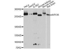 Western blot analysis of extracts of various cell lines, using MTOR antibody. (MTOR Antikörper)