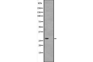 Western blot analysis of ATP6V1D expression in Hela cell lysate,The lane on the left is treated with the antigen-specific peptide. (ATP6V1D Antikörper  (Internal Region))