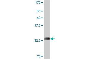 Western Blot detection against Immunogen (37. (STK16 Antikörper  (AA 1-100))