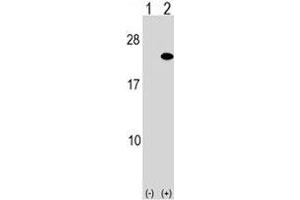 Western blot analysis of ARF5 antibody and 293 cell lysate either nontransfected (Lane 1) or transiently transfected (2) with the ARF5 gene.