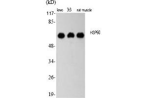 Western Blot analysis of various cells using HSP60 Polyclonal Antibody diluted at 1:2000. (HSPD1 Antikörper  (AA 480-560))