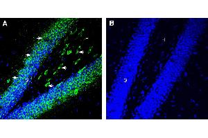 Expression of 5HT6 in mouse hippocampus. (Serotonin Receptor 6 Antikörper  (Extracellular))