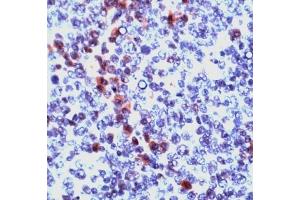 Image no. 1 for anti-Granzyme B (GZMB) (N-Term) antibody (ABIN372968) (GZMB Antikörper  (N-Term))