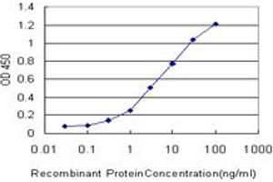 Detection limit for recombinant GST tagged TOM1 is approximately 0. (TOM1 Antikörper  (AA 394-491))