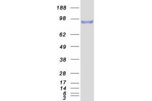 Validation with Western Blot (CTNNB1 Protein (Myc-DYKDDDDK Tag))