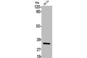 Western Blot analysis of HELA cells using Aldose Reductase Polyclonal Antibody (AKR1B1 Antikörper  (C-Term))