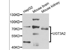 Western blot analysis of extracts of various cell lines, using UGT3A2 antibody. (UGT3A2 Antikörper)