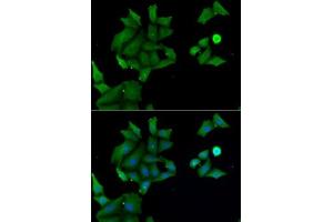 Immunofluorescence analysis of MCF7 cells using H antibody (ABIN6129030, ABIN6141583, ABIN6141584 and ABIN6222656). (HABP2 Antikörper  (AA 24-313))