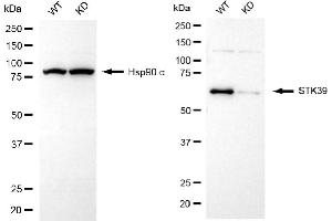 Western blotting analysis using STK39 antibody (ABIN7800304). (Rekombinanter STK39 Antikörper)